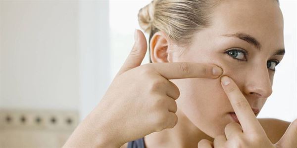 Trị mụn trứng cá bằng sữa mẹ
